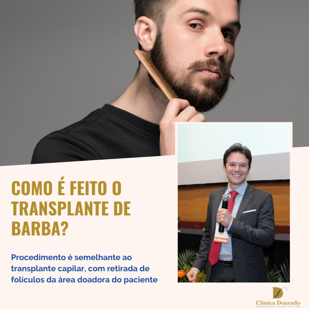 Como é Feito O Transplante De Barba – Dr. Daniel Dourado