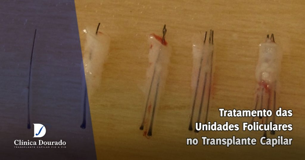tratamento das unidades foliculares para o transplante capilar