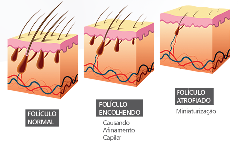 foliculo capilar