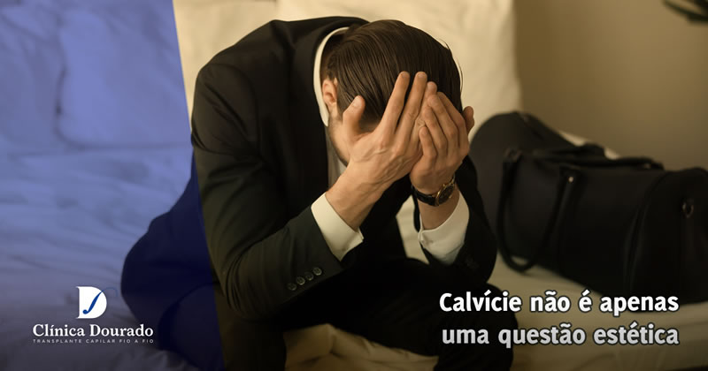 Transplante Capilar em Belo Horizonte O que é, como fazer e como a calvície afeta a autoestima