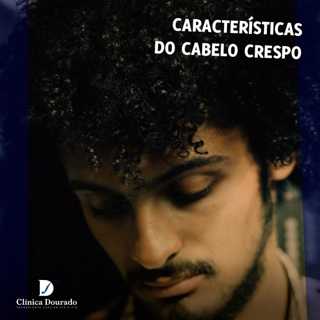 características do cabelo crespo no transplante capilar em Belo Horizonte