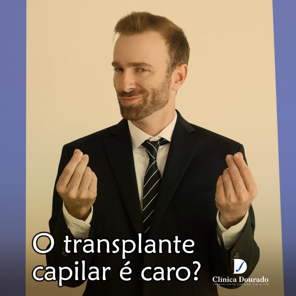 o transplante capilar é caro?