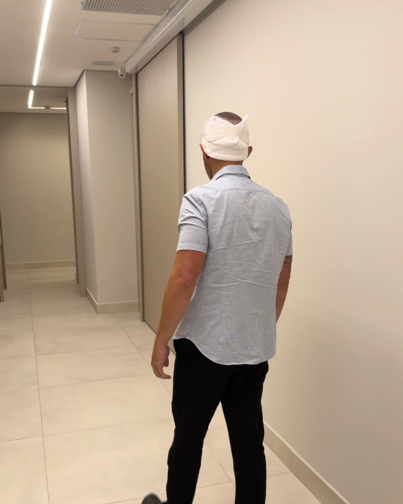 Nicolas Low Cars saindo caminhando depois do transplante capilar